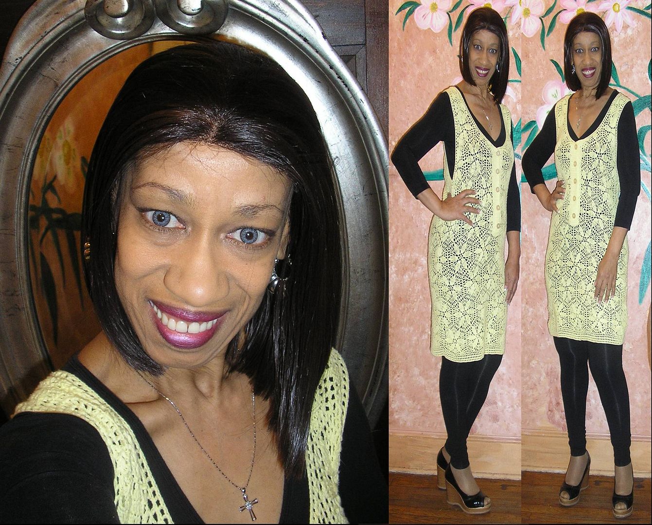 Anyone ever had cortisone injection to the wrist?